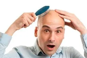 Эркакларнинг сочи нега тўкилиши маълум бўлди